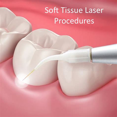 us soft tissue test|what is dental soft tissue.